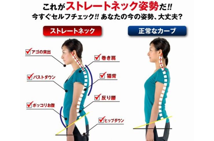 ストレートネック