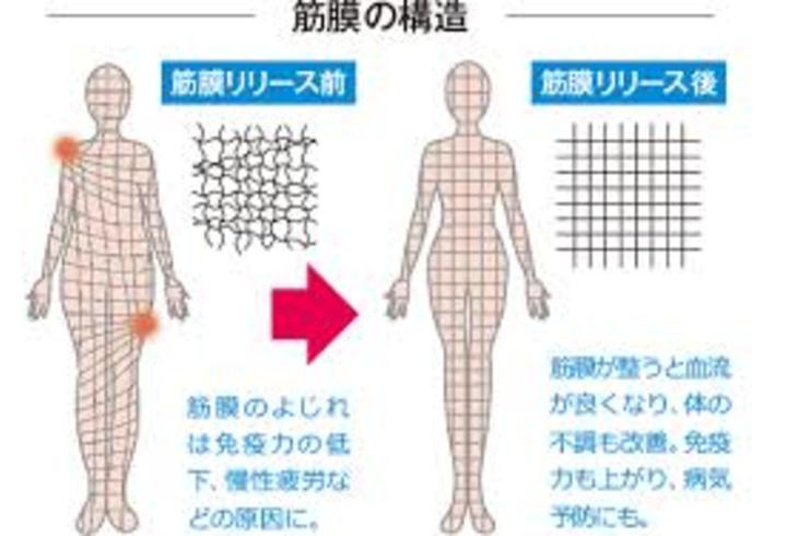 産後整体