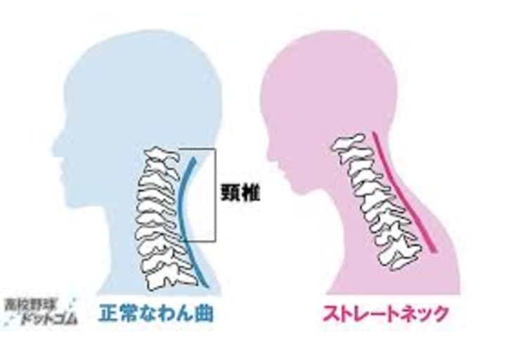 誤解